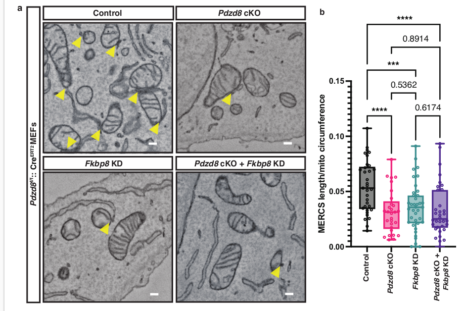 PDZD8-FKBP8 tethering complex at ER-mitochondria contact sites regulates mitochondrial complexity