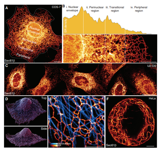 Structural Diversity within the Endoplasmic Reticulum—From the Microscale to the Nanoscale